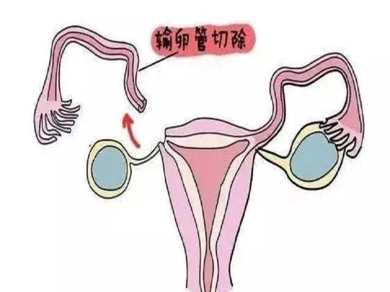 北京找捐卵代妈，包成功代生子